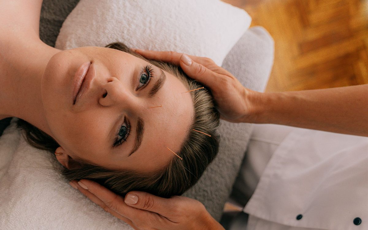 Soin du visage avec de fines aiguilles posées le long de la tempe